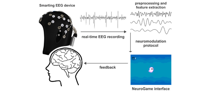 phản hồi thần kinh neurofeedback