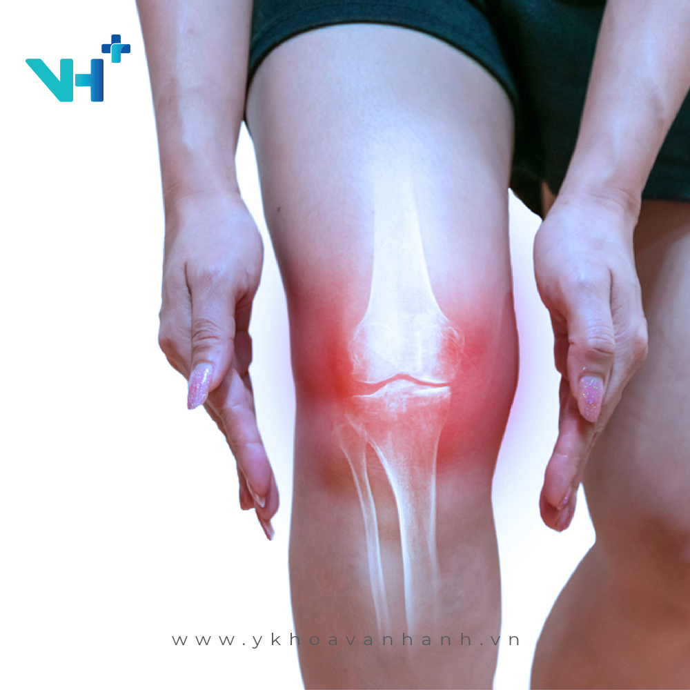 điều trị bệnh cơ xương khớp bằng phương pháp tiêm PRP