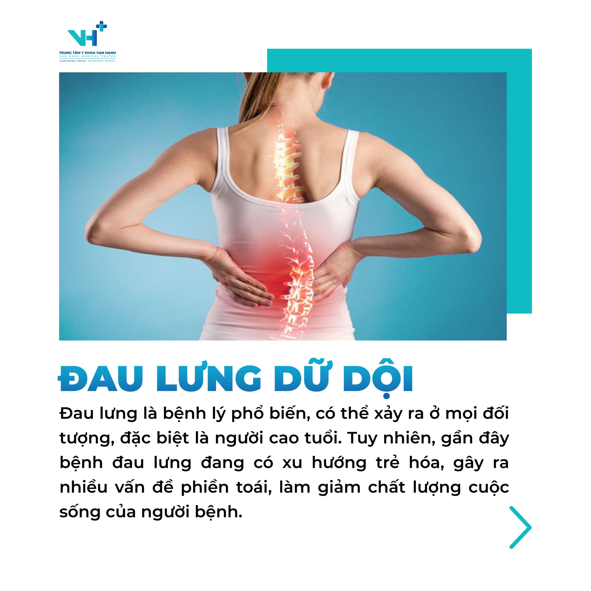 5 dấu hiệu đau lưng báo hiệu thoát vị đĩa đệm chèn ép dây thần kinh