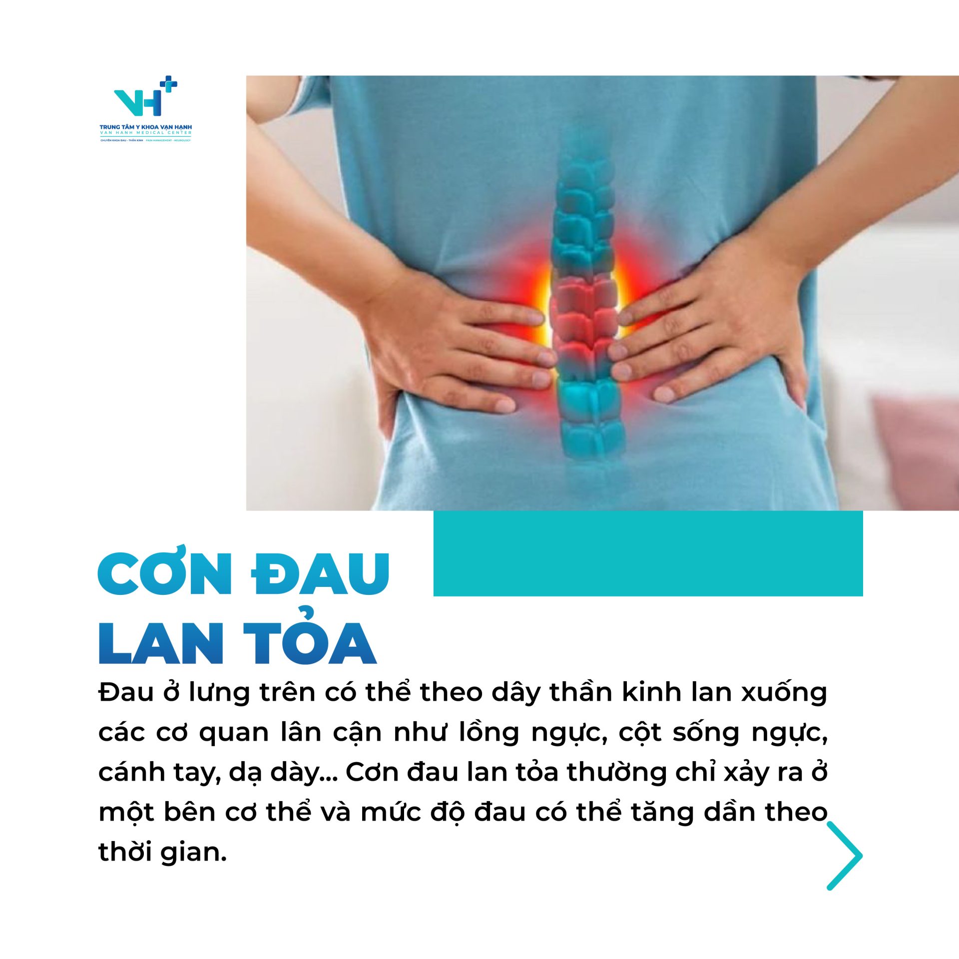 5 dấu hiệu đau lưng báo hiệu thoát vị đĩa đệm chèn ép dây thần kinh