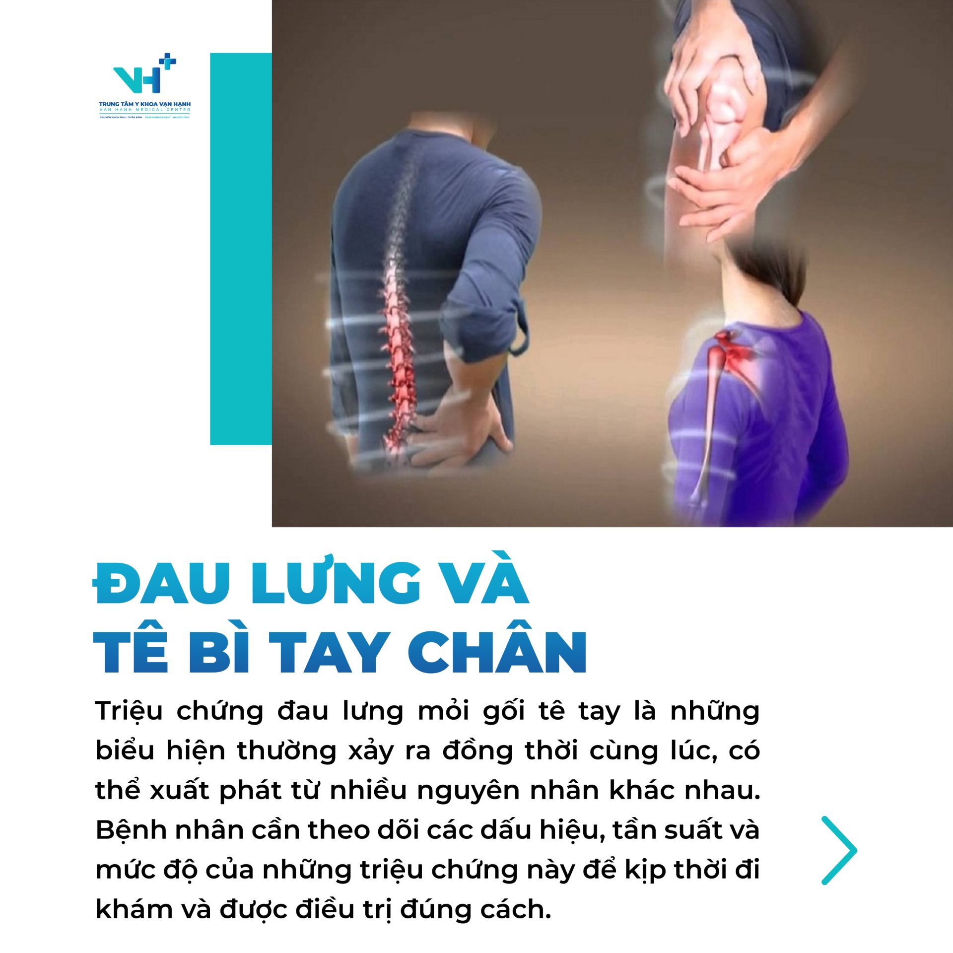 5 dấu hiệu đau lưng báo hiệu thoát vị đĩa đệm chèn ép dây thần kinh