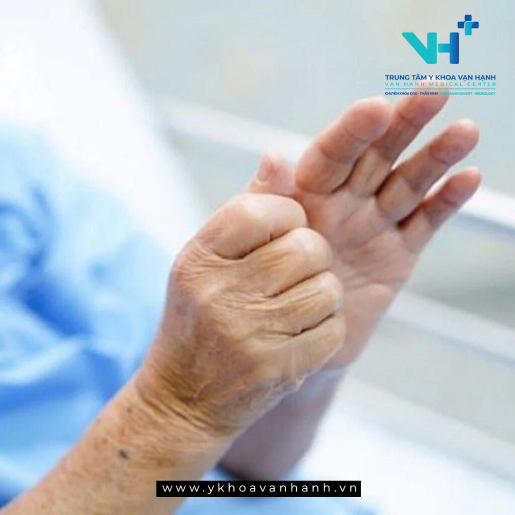 Các yếu tố nguy cơ khác làm khởi phát bệnh Parkinson